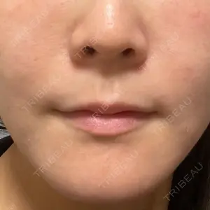 口コミ