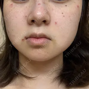 Fellez Clinic【フェルズクリニック】口コミ