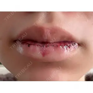 口コミ