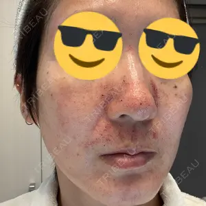 東京シルククリニック 東京シルククリニック 新宿院口コミ