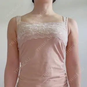 MYCLI MYCLI【マイクリ】大阪・梅田院口コミ