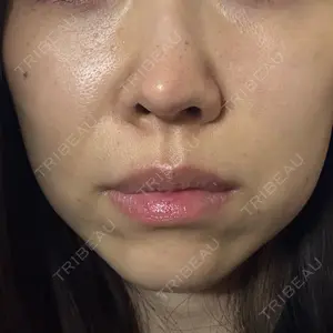 Nebula Clinic 小倉美容外科ネビュラクリニック口コミ