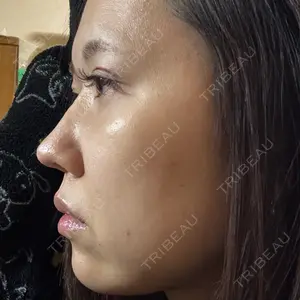 Nebula Clinic 小倉美容外科ネビュラクリニック口コミ