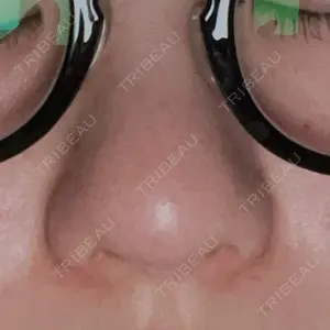 PRISM Beauty Clinic  PRISM Beauty Clinic 新宿院口コミ