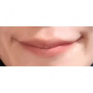 口コミ