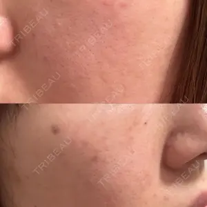 ライズワン美容皮膚科クリニック口コミ