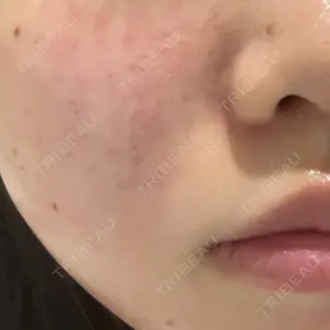 APスキンクリニック銀座口コミ