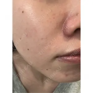 APスキンクリニック銀座口コミ
