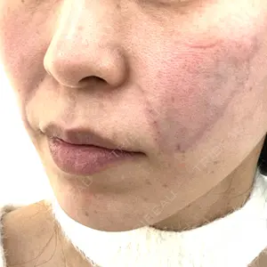 APスキンクリニック銀座口コミ