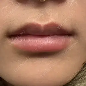 口コミ