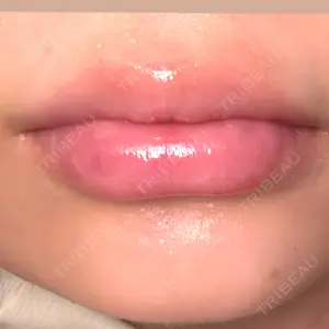 BiBiクリニック口コミ