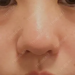 PRISM Beauty Clinic  PRISM Beauty Clinic 新宿院口コミ