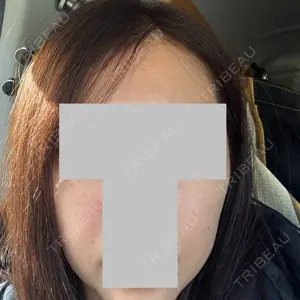 plume clinic plume clinic口コミ