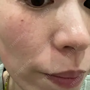 新宿Ladies&Gentlemen美容クリニック口コミ