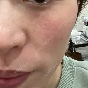 新宿Ladies&Gentlemen美容クリニック口コミ