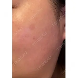 ルラ美容クリニック ルラ美容クリニック 郡山院口コミ