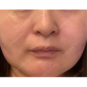 ルラ美容クリニック ルラ美容クリニック 郡山院口コミ