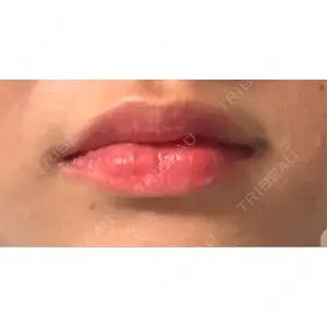 LOUIS CLINIC 二子玉川院【ルイクリニック】口コミ