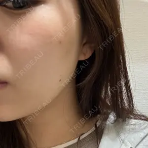 ルラ美容クリニック ルラ美容クリニック 大阪心斎橋院口コミ