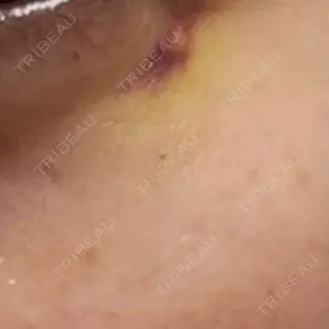 アイビークリニック 千葉美容外科アイビークリニック口コミ