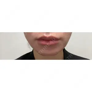 ルラ美容クリニック ルラ美容クリニック 郡山院口コミ