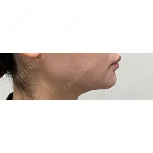 ルラ美容クリニック ルラ美容クリニック 郡山院口コミ