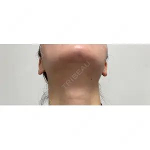 ルラ美容クリニック ルラ美容クリニック 郡山院口コミ