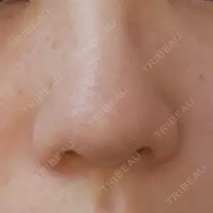 PRISM Beauty Clinic  PRISM Beauty Clinic 新宿院口コミ