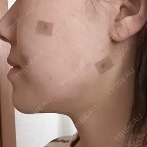 ルラ美容クリニック ルラ美容クリニック 郡山院口コミ