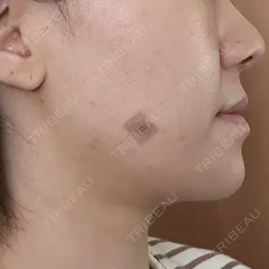 ルラ美容クリニック ルラ美容クリニック 郡山院口コミ