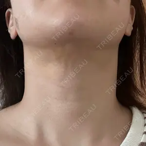 ルラ美容クリニック ルラ美容クリニック 郡山院口コミ