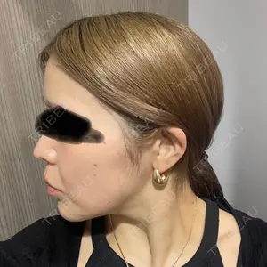 ASTRA BEAUTY CLINIC口コミ