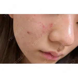 日本美容・医療クリニック 日本美容・医療クリニック 六本木院口コミ