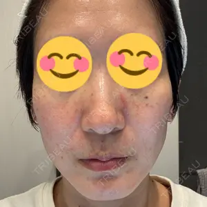 東京シルククリニック 東京シルククリニック 新宿院口コミ