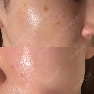 ライズワン美容皮膚科クリニック口コミ