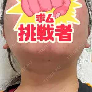 アイビークリニック 千葉美容外科アイビークリニック口コミ