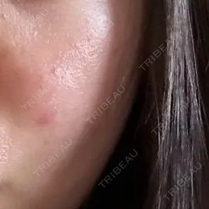 TUNE CLINIC【チューンクリニック】口コミ