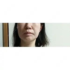 BIZENNクリニック【ビゼンクリニック】口コミ