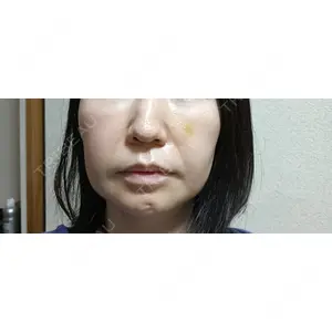 BIZENNクリニック【ビゼンクリニック】口コミ