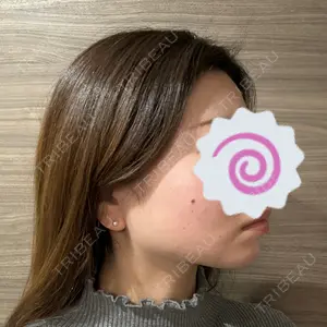 L‘amour clinic Tokyo【ラムールクリニック東京】口コミ