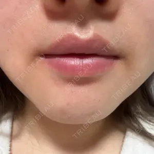 麻布十番クレールデンタルクリニック口コミ