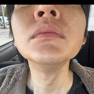 湘南美容クリニック 豊田院の