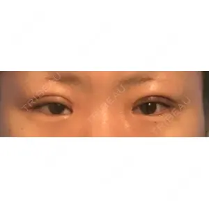 アリエル美容クリニック アリエル美容クリニック 水戸院口コミ