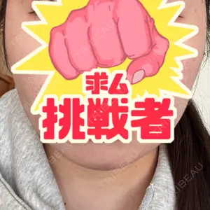 アイビークリニック 千葉美容外科アイビークリニック口コミ