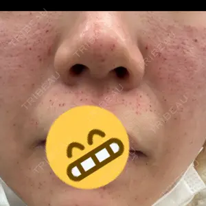 DIAV（ディアブ） クリニック口コミ