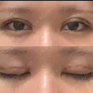 Nebula Clinic 新宿美容外科ネビュラクリニック口コミ
