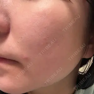 やさしい美容皮膚科・皮フ科 やさしい美容皮膚科・皮フ科　秋葉原院口コミ