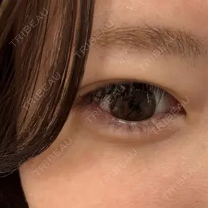 HAAB CLINIC HAAB×DREAM BEAUTY CLINIC 東京本院口コミ