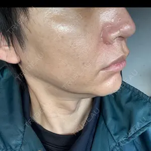 湘南美容クリニック 豊田院の