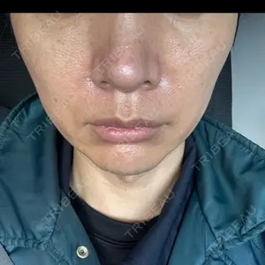 湘南美容クリニック 豊田院の